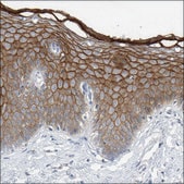 Anti-DSG1 antibody produced in rabbit Prestige Antibodies® Powered by Atlas Antibodies, affinity isolated antibody, buffered aqueous glycerol solution