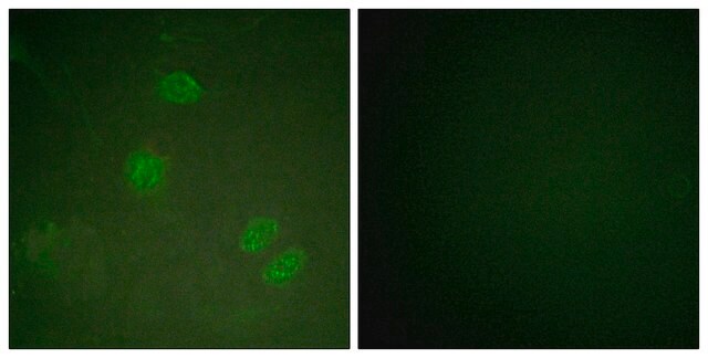 Anti-ELK3 antibody produced in rabbit affinity isolated antibody