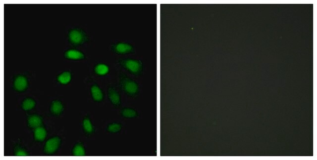 Anti-SCAND1 antibody produced in rabbit affinity isolated antibody