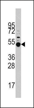 ANTI-PRAK (MAPKAPK5) (T182) antibody produced in rabbit affinity isolated antibody, buffered aqueous solution