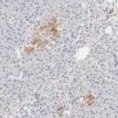 Anti-PKDCC antibody produced in rabbit Prestige Antibodies® Powered by Atlas Antibodies, affinity isolated antibody, buffered aqueous glycerol solution, ab1