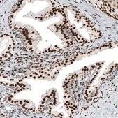 Monoclonal Anti-AR antibody produced in mouse Prestige Antibodies® Powered by Atlas Antibodies, clone CL9255, purified immunoglobulin, buffered aqueous glycerol solution