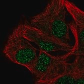 Anti-AP5B1 antibody produced in rabbit Prestige Antibodies&#174; Powered by Atlas Antibodies, affinity isolated antibody, buffered aqueous glycerol solution
