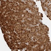Anti-ZNF678 antibody produced in rabbit Prestige Antibodies® Powered by Atlas Antibodies, affinity isolated antibody, buffered aqueous glycerol solution