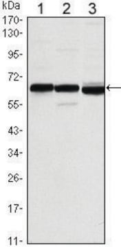 Monoclonal Anti-ESR1 antibody produced in mouse clone 6B6, ascites fluid