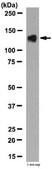 Anti-PP6R3 Antibody from rabbit, purified by affinity chromatography