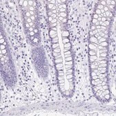 Anti-PRR27 antibody produced in rabbit Prestige Antibodies&#174; Powered by Atlas Antibodies, affinity isolated antibody, buffered aqueous glycerol solution
