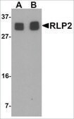 Anti-RILPL2 antibody produced in rabbit affinity isolated antibody