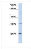 Anti-CDC42 antibody produced in rabbit affinity isolated antibody