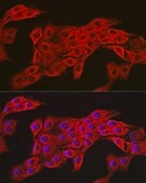 Anti- AMPK&#945;2 antibody produced in rabbit