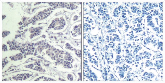 Anti-phospho-AKT1/AKT2/AKT3 (pTyr315/pTyr316/pTyr312) antibody produced in rabbit affinity isolated antibody