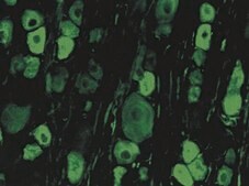 Anti-Internexin &#945; Antibody serum, Chemicon&#174;
