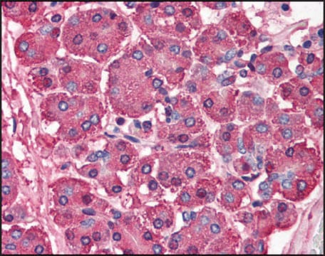 Anti-SKI antibody produced in rabbit affinity isolated antibody, buffered aqueous solution