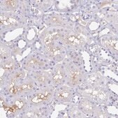 Anti-A1BG antibody produced in rabbit Prestige Antibodies&#174; Powered by Atlas Antibodies, affinity isolated antibody, buffered aqueous glycerol solution