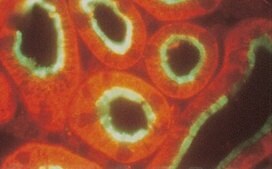 Anti-Na+/H+ Exchanger-3 Antibody, isoform NHE3, clone 4F5 clone 4F5, Chemicon&#174;, from mouse