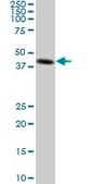 Monoclonal Anti-CKMT1B antibody produced in mouse clone 2C8, purified immunoglobulin, buffered aqueous solution