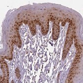 Anti-S100A2 antibody produced in rabbit Prestige Antibodies&#174; Powered by Atlas Antibodies, affinity isolated antibody, buffered aqueous glycerol solution