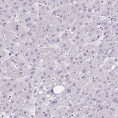 Anti-HSD11B2 antibody produced in rabbit Prestige Antibodies&#174; Powered by Atlas Antibodies, affinity isolated antibody, buffered aqueous glycerol solution