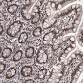 Anti-DMTF1 antibody produced in rabbit Prestige Antibodies&#174; Powered by Atlas Antibodies, affinity isolated antibody, buffered aqueous glycerol solution