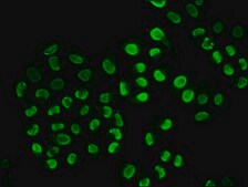 Anti-phospho-SNCA (S129) antibody, clone 4G3, Rabbit Monoclonal recombinant, expressed in HEK293F cells