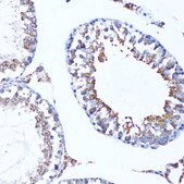 Anti-MAP1LC3A antibody produced in rabbit