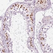 Anti-BEND2 antibody produced in rabbit Prestige Antibodies&#174; Powered by Atlas Antibodies, affinity isolated antibody, buffered aqueous glycerol solution