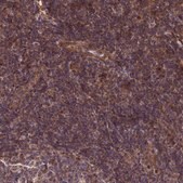 Anti-ZNF467 antibody produced in rabbit Prestige Antibodies® Powered by Atlas Antibodies, affinity isolated antibody, buffered aqueous glycerol solution