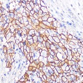 Anti-NDRG1 antibody produced in rabbit