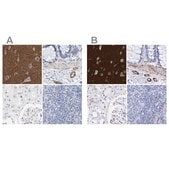 Anti-AMPH antibody produced in rabbit Prestige Antibodies&#174; Powered by Atlas Antibodies, affinity isolated antibody, buffered aqueous glycerol solution, Ab1