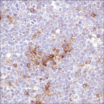 Anti-VPAC1 antibody, Rabbit monoclonal recombinant, expressed in proprietary host, clone SP234, affinity isolated antibody