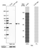 Anti-TES antibody produced in rabbit Prestige Antibodies&#174; Powered by Atlas Antibodies, affinity isolated antibody, buffered aqueous glycerol solution