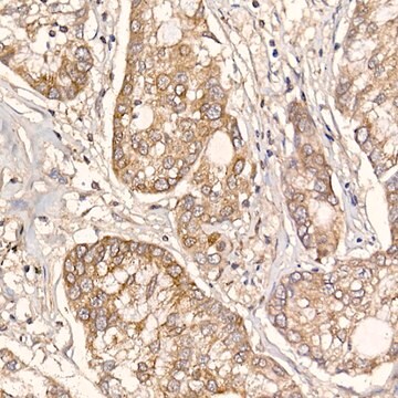 Anti-ERp19 Antibody, clone 9J6L2, Rabbit Monoclonal