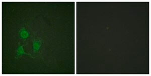 Anti-phospho-PKA &#945;/&#946; CAT (pThr197) antibody produced in rabbit affinity isolated antibody