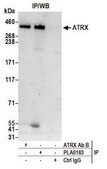 Rabbit anti-ATRX Antibody, Affinity Purified Powered by Bethyl Laboratories, Inc.
