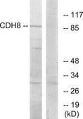 Anti-CDH8 antibody produced in rabbit affinity isolated antibody