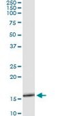 Monoclonal Anti-SLURP1 antibody produced in mouse clone 4D1, purified immunoglobulin, buffered aqueous solution