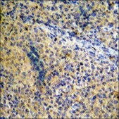 Anti-phospho-FANCA (pSer1149) antibody produced in rabbit affinity isolated antibody