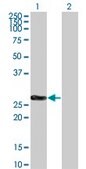 Monoclonal Anti-CDKN1B, (C-terminal) antibody produced in mouse clone 2F4, purified immunoglobulin, buffered aqueous solution
