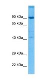 Anti-HMGCLL1, (N-terminal) antibody produced in rabbit affinity isolated antibody
