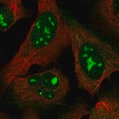 Anti-MYL5 antibody produced in rabbit Prestige Antibodies&#174; Powered by Atlas Antibodies, affinity isolated antibody, buffered aqueous glycerol solution