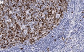 Anti-Topoisomerase II Antibody, clone 3C3 ZooMAb&#174; Rabbit Monoclonal recombinant, expressed in HEK 293 cells
