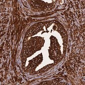 Anti-KIAA1468 antibody produced in rabbit Prestige Antibodies® Powered by Atlas Antibodies, affinity isolated antibody, buffered aqueous glycerol solution