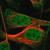 Anti-IQCE antibody produced in rabbit Prestige Antibodies® Powered by Atlas Antibodies, affinity isolated antibody, buffered aqueous glycerol solution