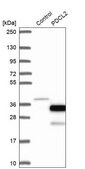 Anti-PDCL2 antibody produced in rabbit Prestige Antibodies&#174; Powered by Atlas Antibodies, affinity isolated antibody, buffered aqueous glycerol solution