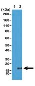 Anti-trimethyl Histone H3 (Lys36) Antibody, clone RM155 clone RM155, from rabbit