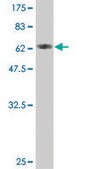 ANTI-TUBA1 antibody produced in mouse clone 2E9, purified immunoglobulin, buffered aqueous solution