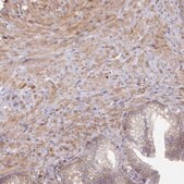 Anti-SH3PXD2B antibody produced in rabbit Prestige Antibodies&#174; Powered by Atlas Antibodies, affinity isolated antibody, buffered aqueous glycerol solution