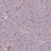 Anti-LYPLA1 antibody produced in rabbit Prestige Antibodies&#174; Powered by Atlas Antibodies, affinity isolated antibody, buffered aqueous glycerol solution