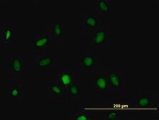 Monoclonal Anti-HDAC1 antibody produced in mouse clone 1D6, purified immunoglobulin, buffered aqueous solution