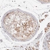 Anti-RNF146 antibody produced in rabbit Prestige Antibodies® Powered by Atlas Antibodies, affinity isolated antibody, buffered aqueous glycerol solution, ab2